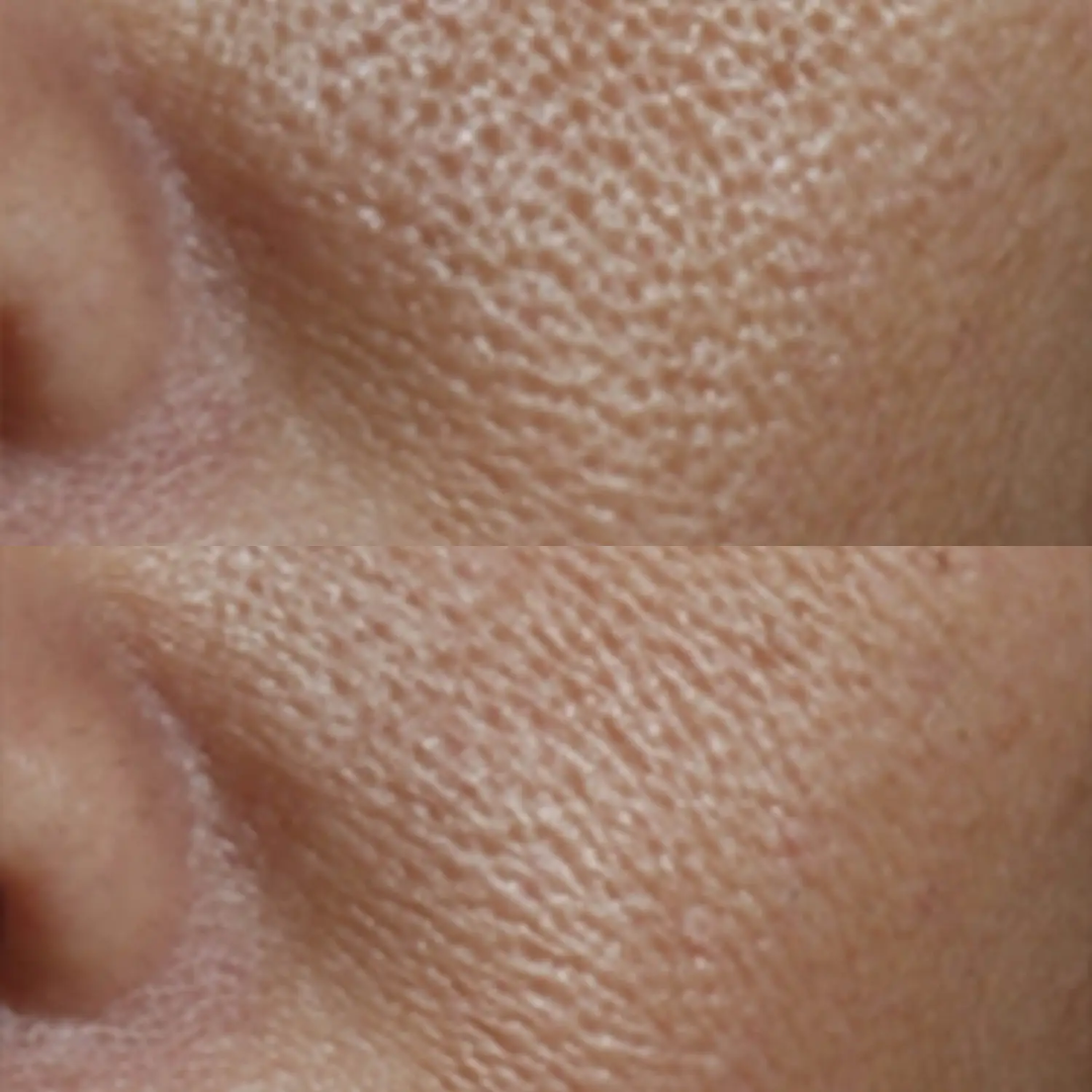 Perricone MD - No Rinse Intensive Pore Minimizing Toner - 4 Oz