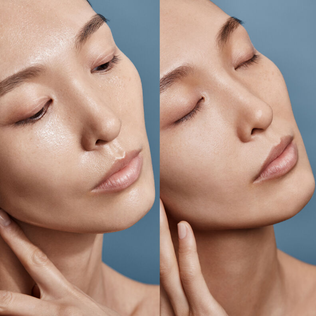 Cle De Peau - Essential Refining Essence - 5.7 Oz