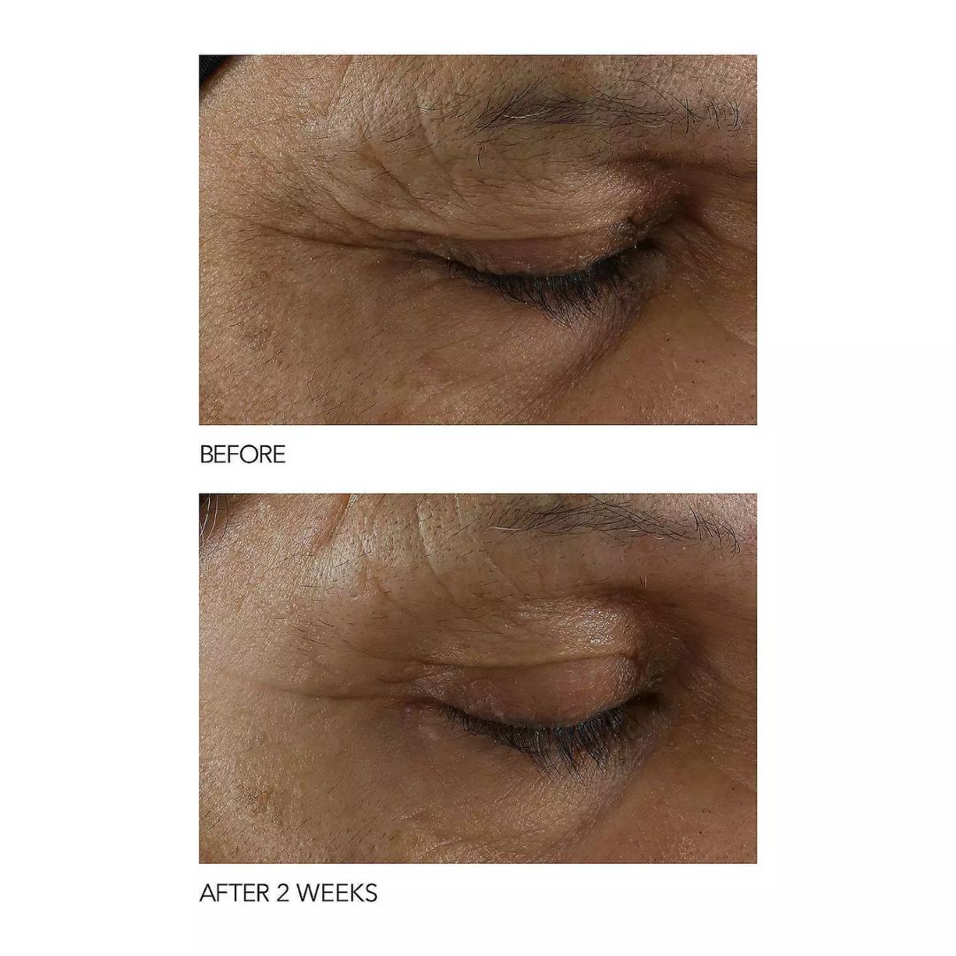 Dr. Dennis Gross - Stress SOS Eye Cream with Niacinamide - 0.5 Oz