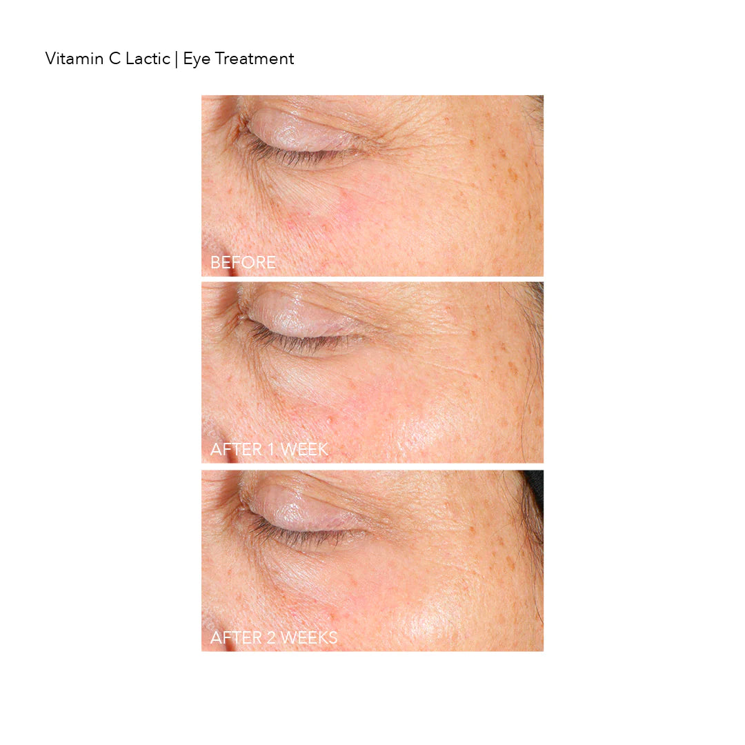 Dr. Dennis Gross - Vitamin C Lactic Firm & Bright Eye Treatment - 0.5 Oz Set of 2