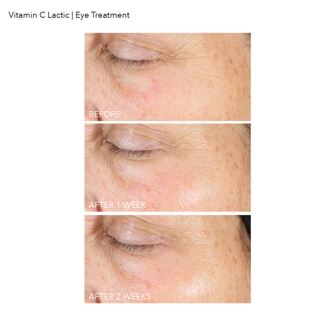 Dr. Dennis Gross - Vitamin C Plus Lactic Firm and Bright Eye Treatment - 0.5 Oz