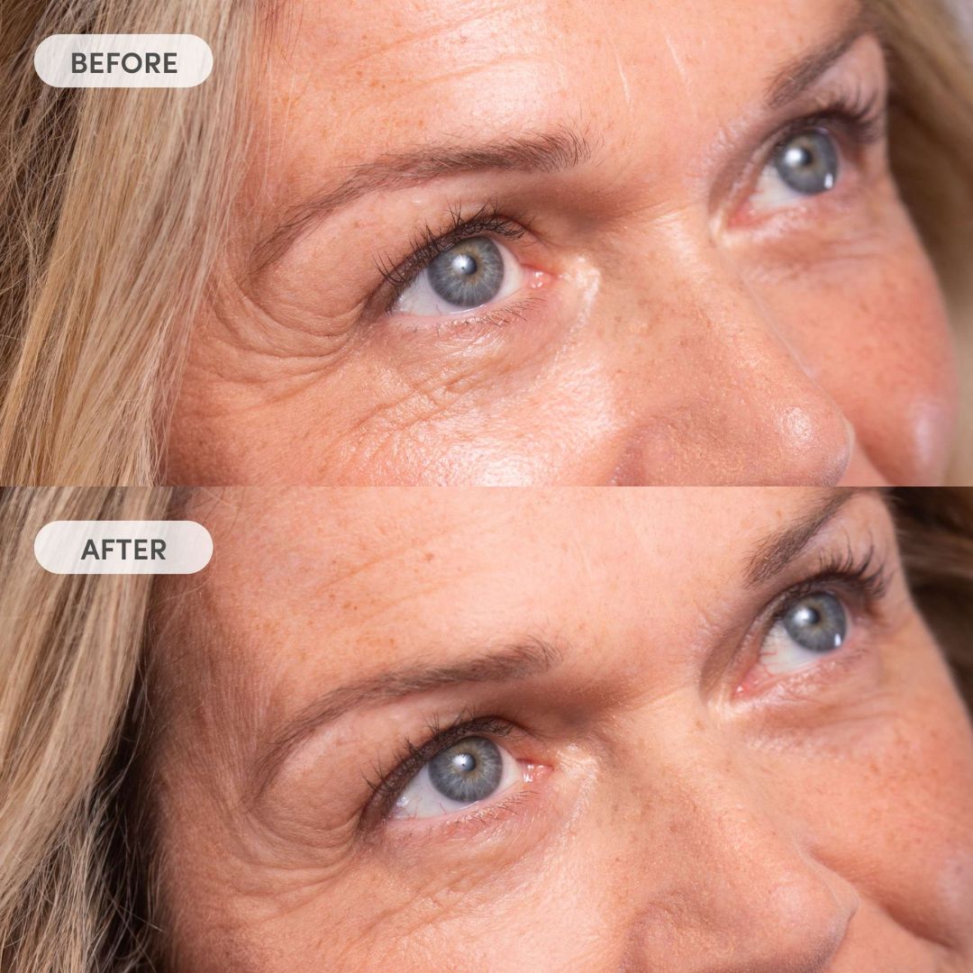 L'Oreal - Miracle Blur Instant Skin Smoother SPF 30 - 1.18 Oz