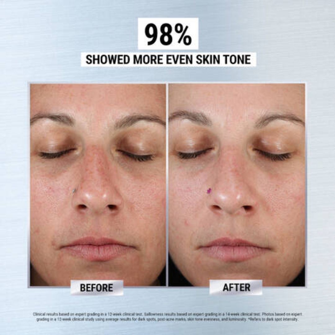 Kiehl's - Clearly Corrective Dark Spot Solution - 3.4 Oz