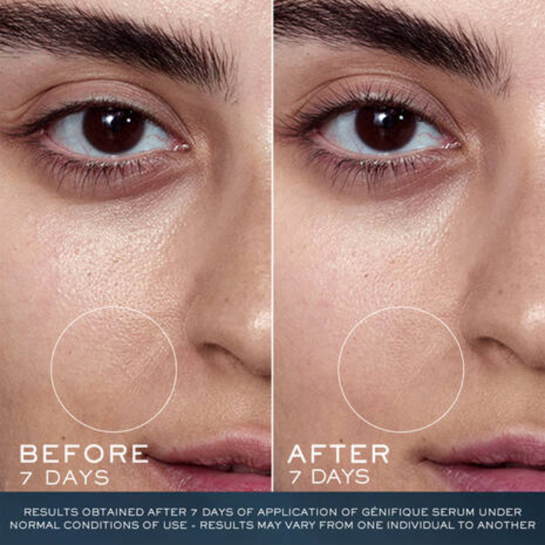 Lancome - Advanced Genifique Youth Activating Concentrate Face Serum - 3.3 Oz