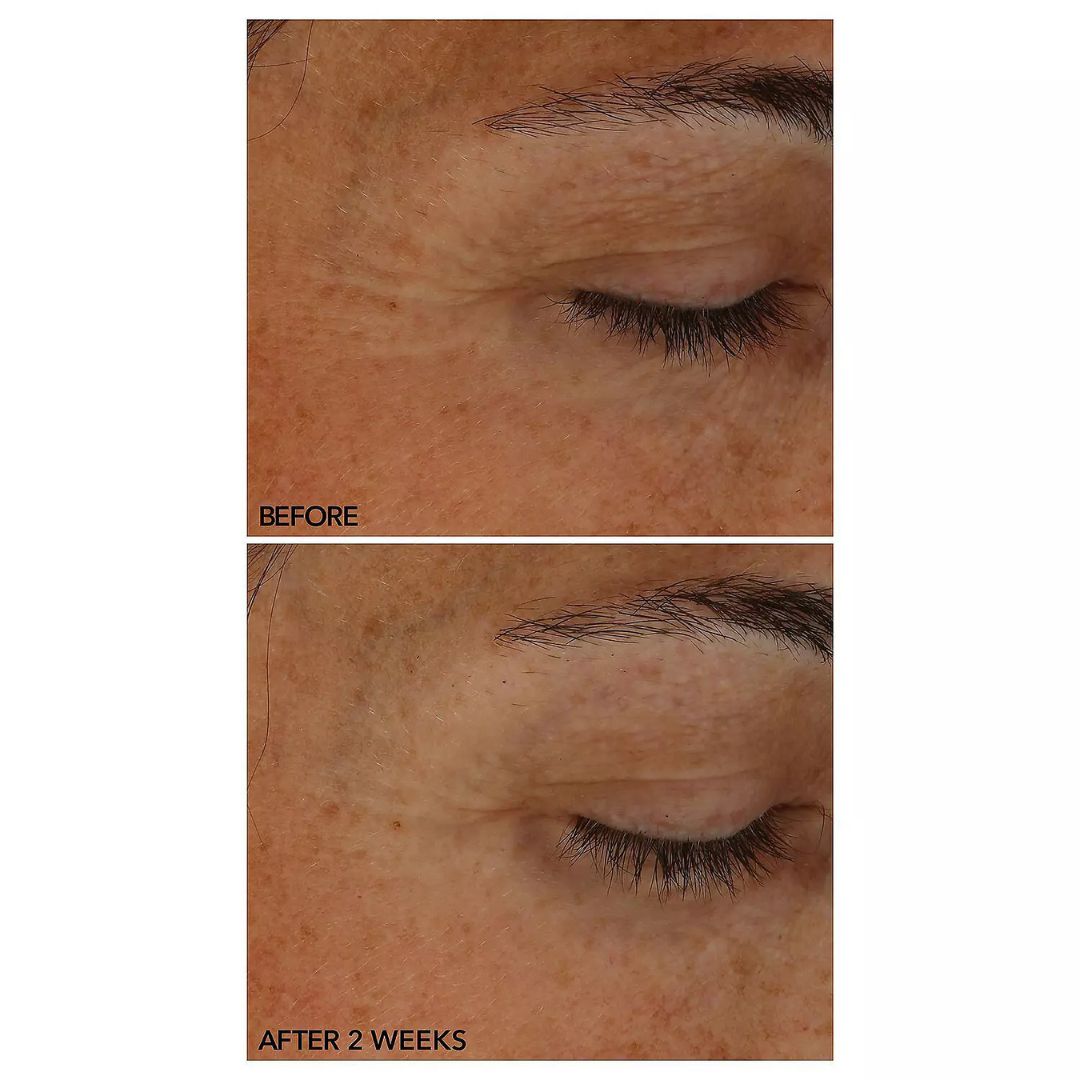 Dr. Dennis Gross - Stress SOS Eye Cream with Niacinamide - 0.5 Oz