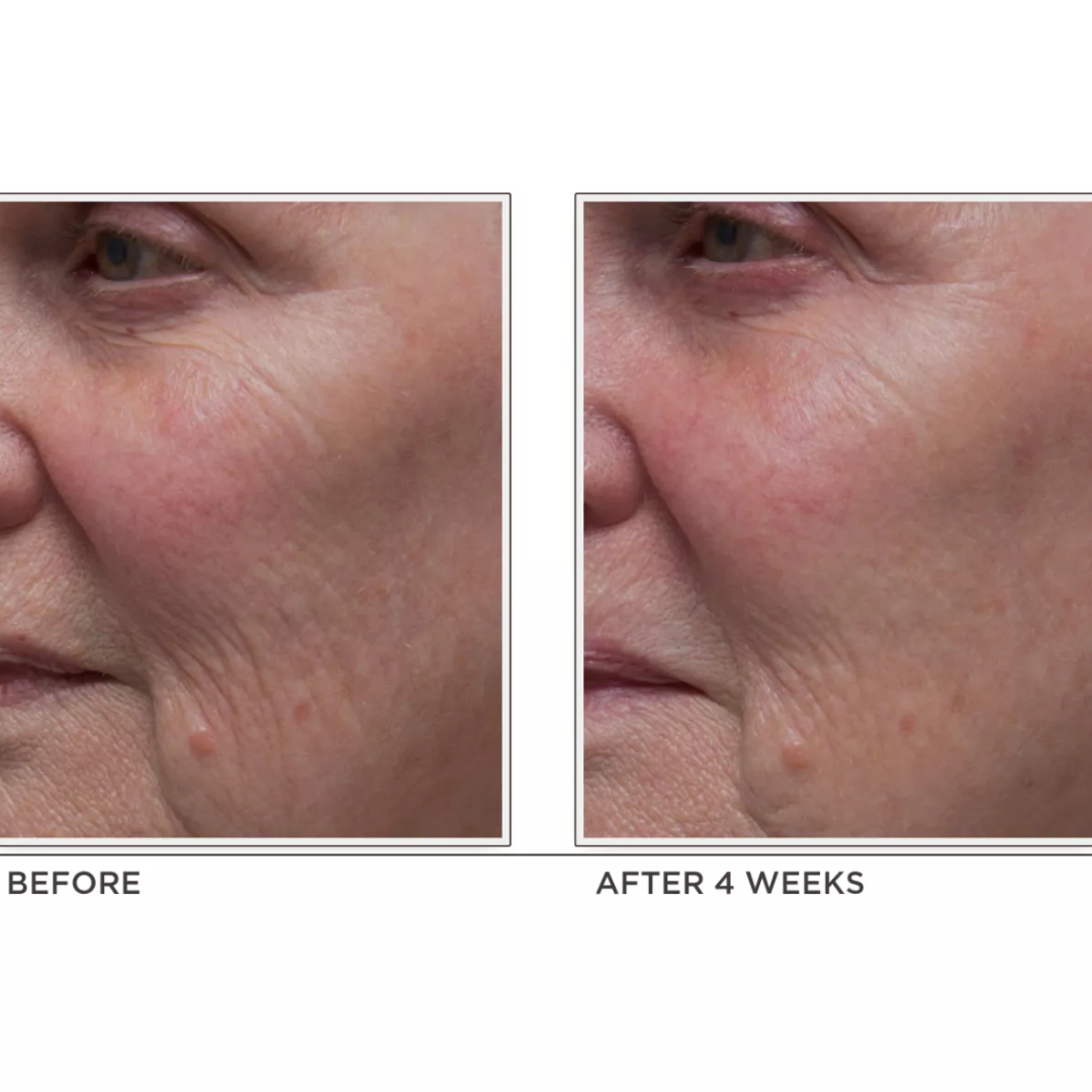 Perricone Md - Neuropeptide Facial Cream - 2 Oz