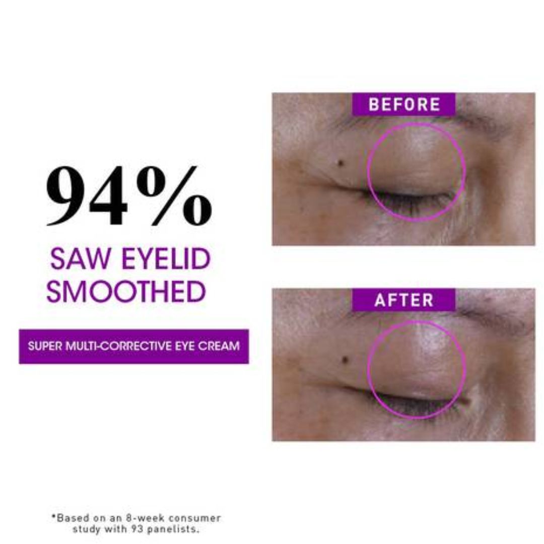 Kiehl's - Super Multi Corrective Eye Zone Treatment - 0.95 Oz