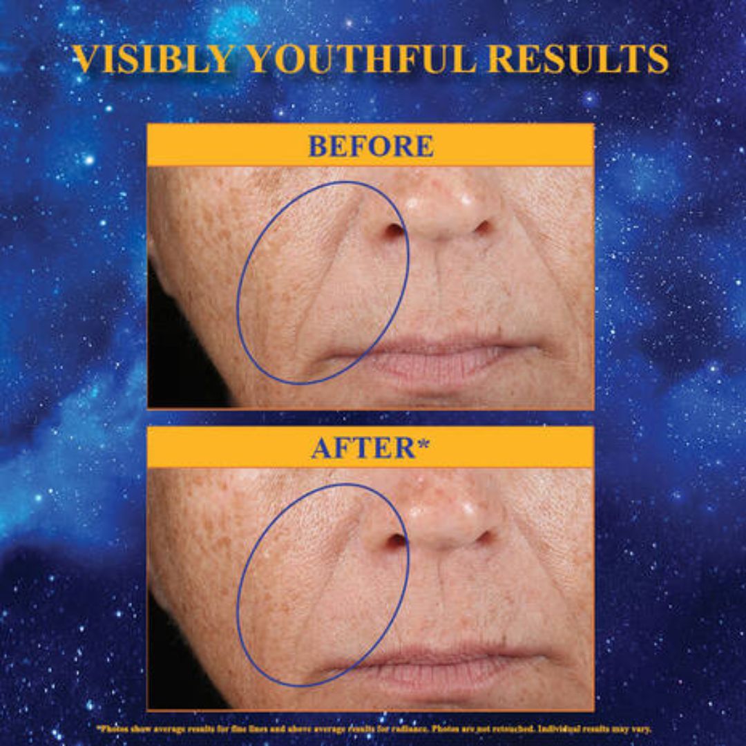 Kiehl's - Midnight Recovery Concentrate - 3.4 Oz