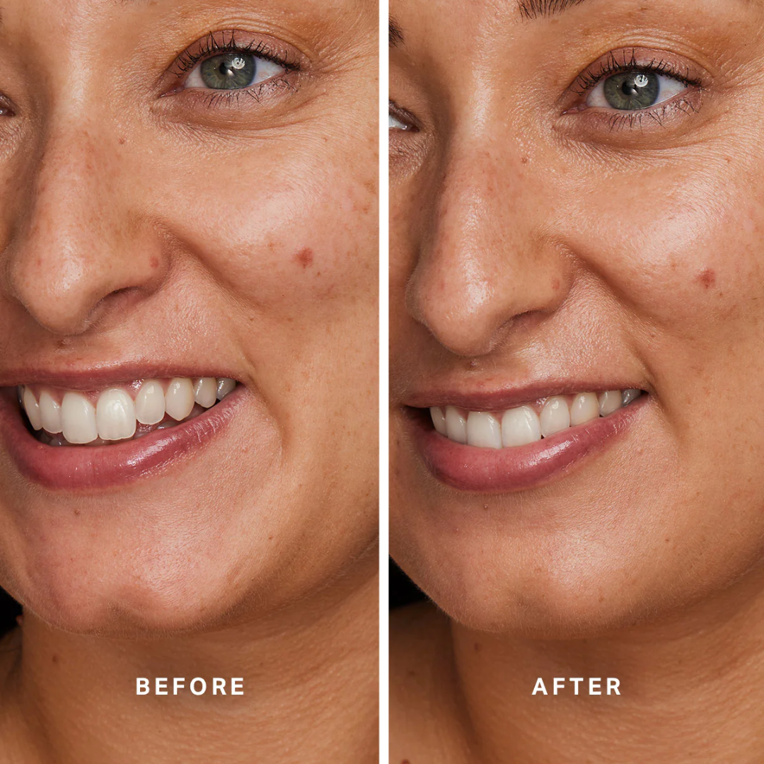 Alpha-H - Total Eclipse Mineral SPF 40 - 1.35 Oz