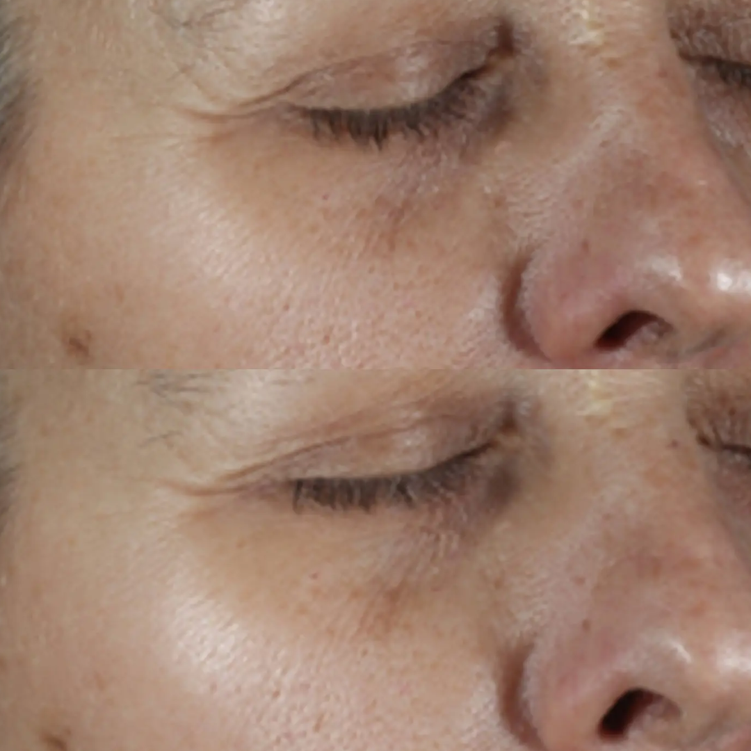 Perricone MD - Vitamin C Ester Brightening Amine Face Lift - 2 Oz