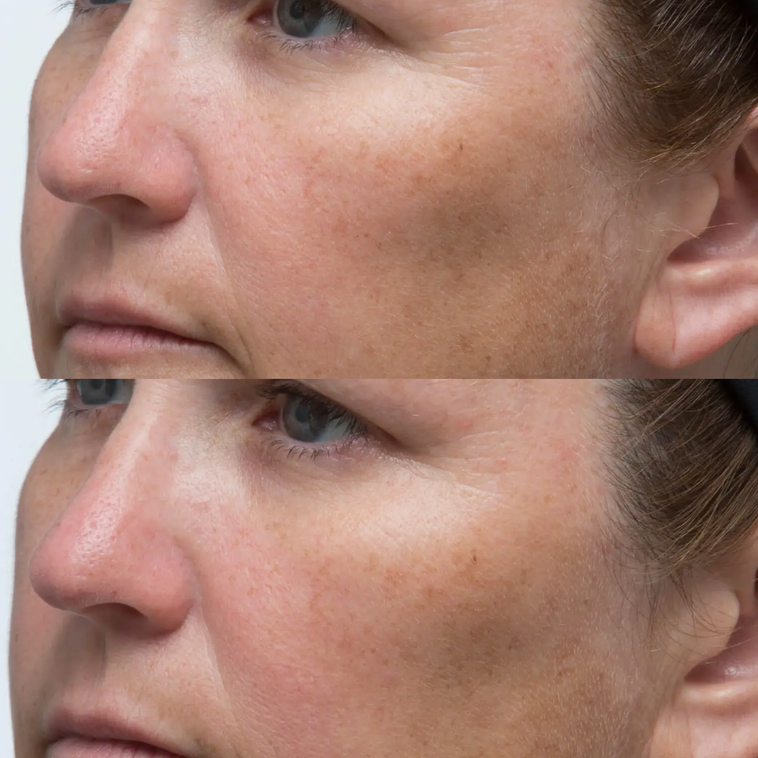 Perricone MD - High Potency Classics Hyaluronic Intensive Moisturizer - 1 Oz