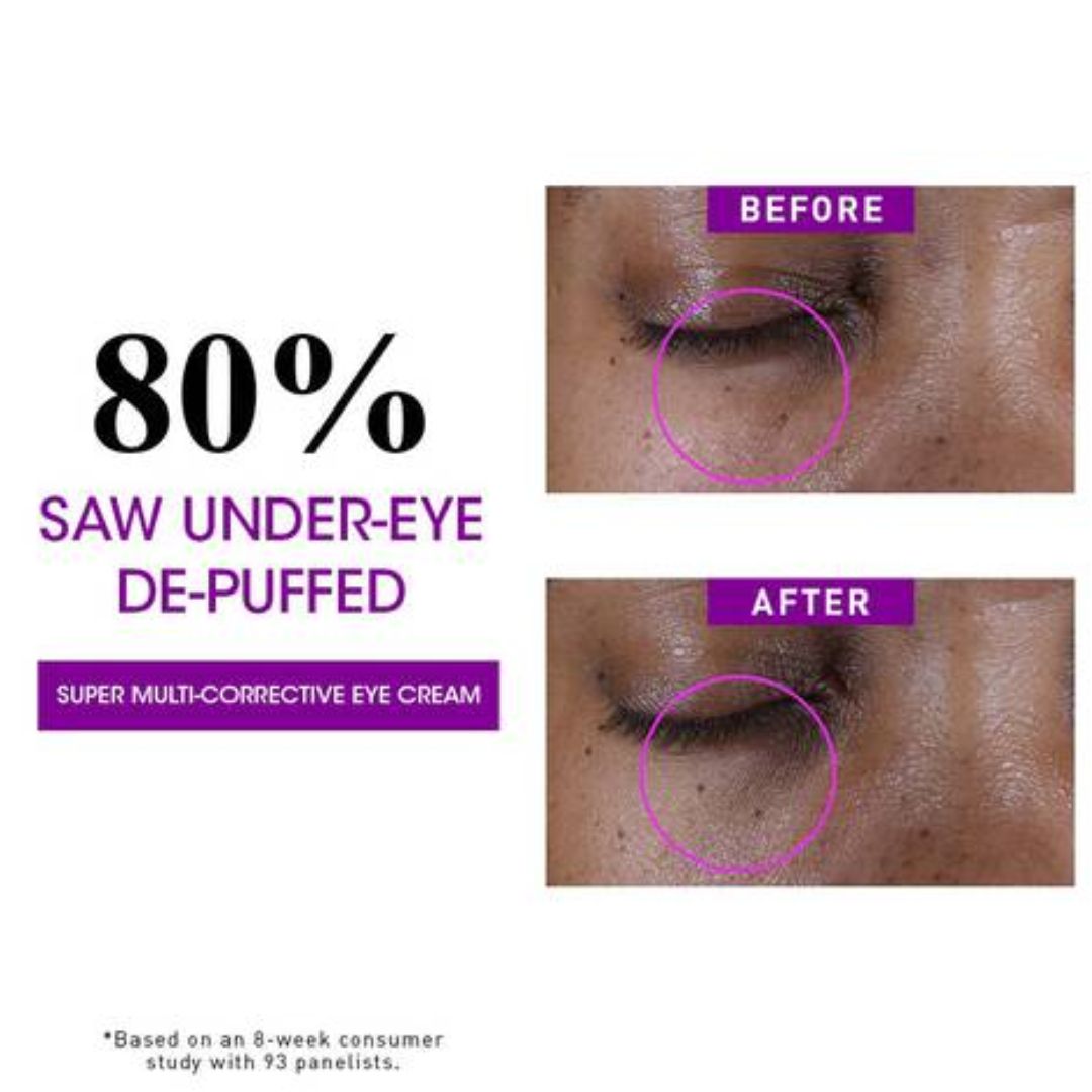 Kiehl's - Super Multi Corrective Eye Zone Treatment - 0.95 Oz