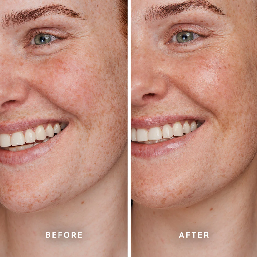 Alpha-H - Total Eclipse Mineral SPF 40 - 1.35 Oz