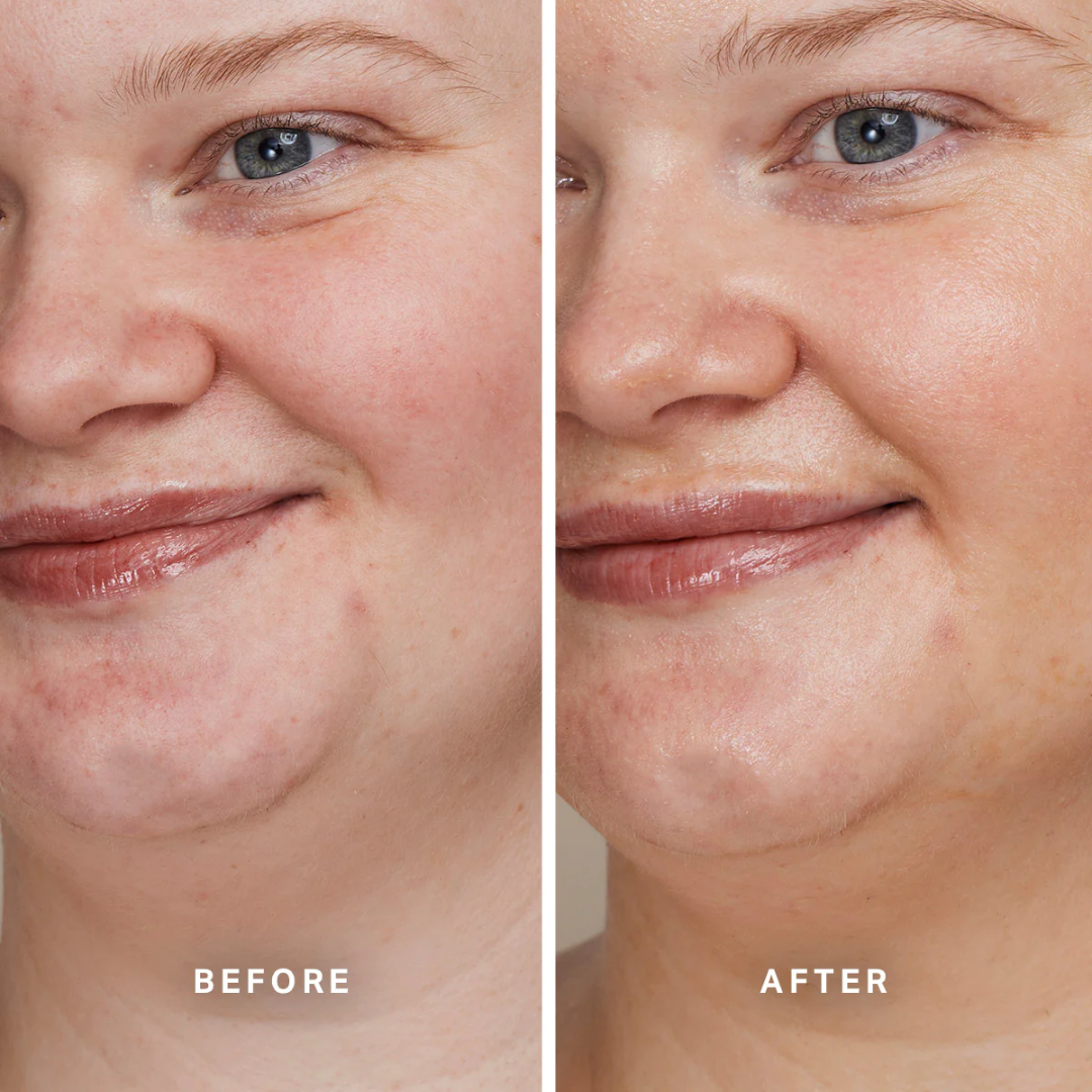 Alpha-H - Total Eclipse Mineral SPF 40 - 1.35 Oz